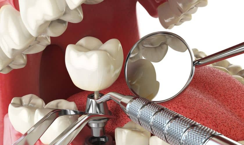 Innovations in Dentistry: Cutting-Edge Technologies Transforming Dental Practices