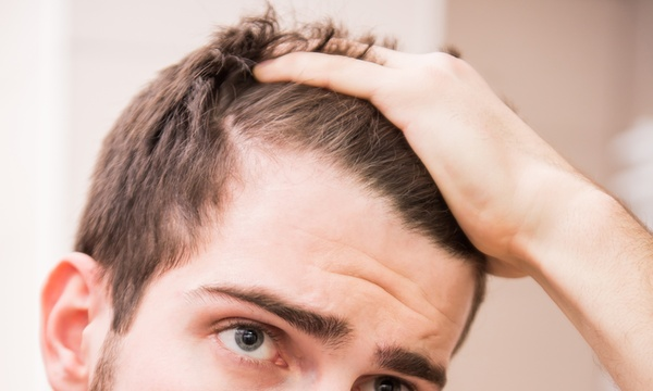 Hair Loss Solutions In Houston