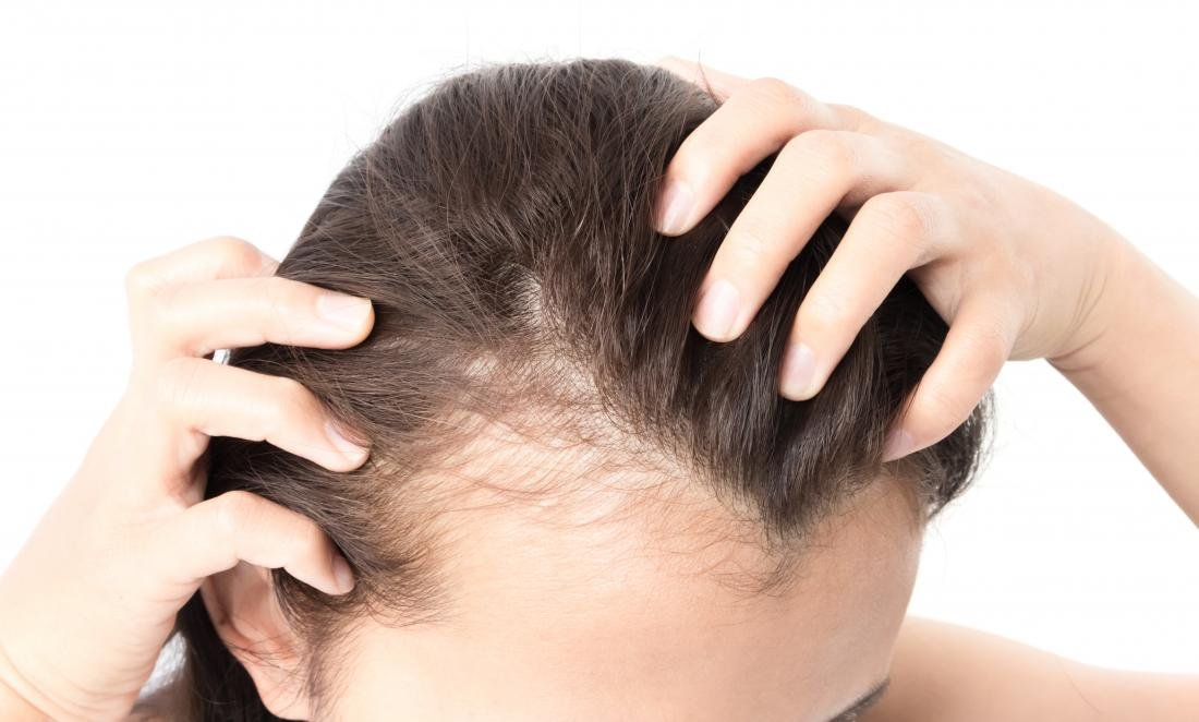 From Thinning to Thriving: How PRP Treatment Restores Hair Density